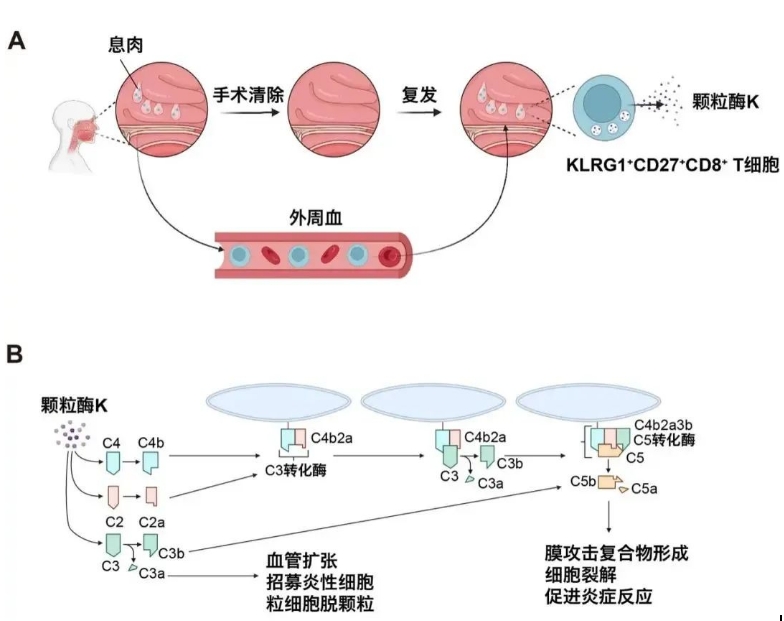 清华大学与北京同仁医院团队发表研究 揭示慢性鼻病复发关键机制