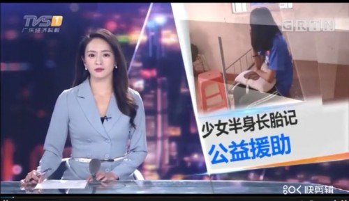 带着“红色面具”的女孩，公益的暖阳让她再次起舞