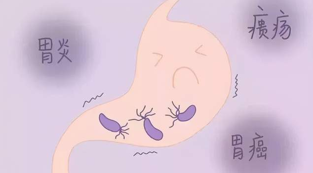 德州市第二人民医院胃肠外科专家：幽门螺旋杆菌极易导致全家感染