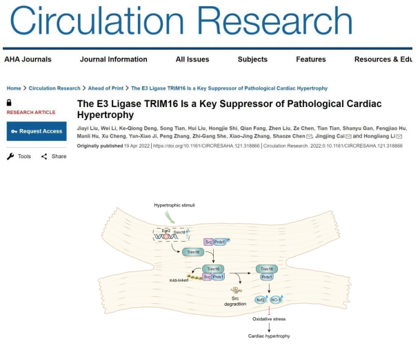  我国科学家在心血管代谢领域连续取得突破性科研进展