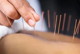 中医药在海外“出圈”了