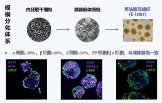 我国团队推出再生胰岛微创移植